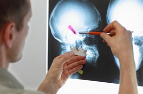 Doctor examining jaw X-ray to plan corrective jaw surgery