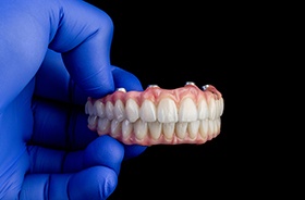 Gloved hand holding upper and lower implant dentures